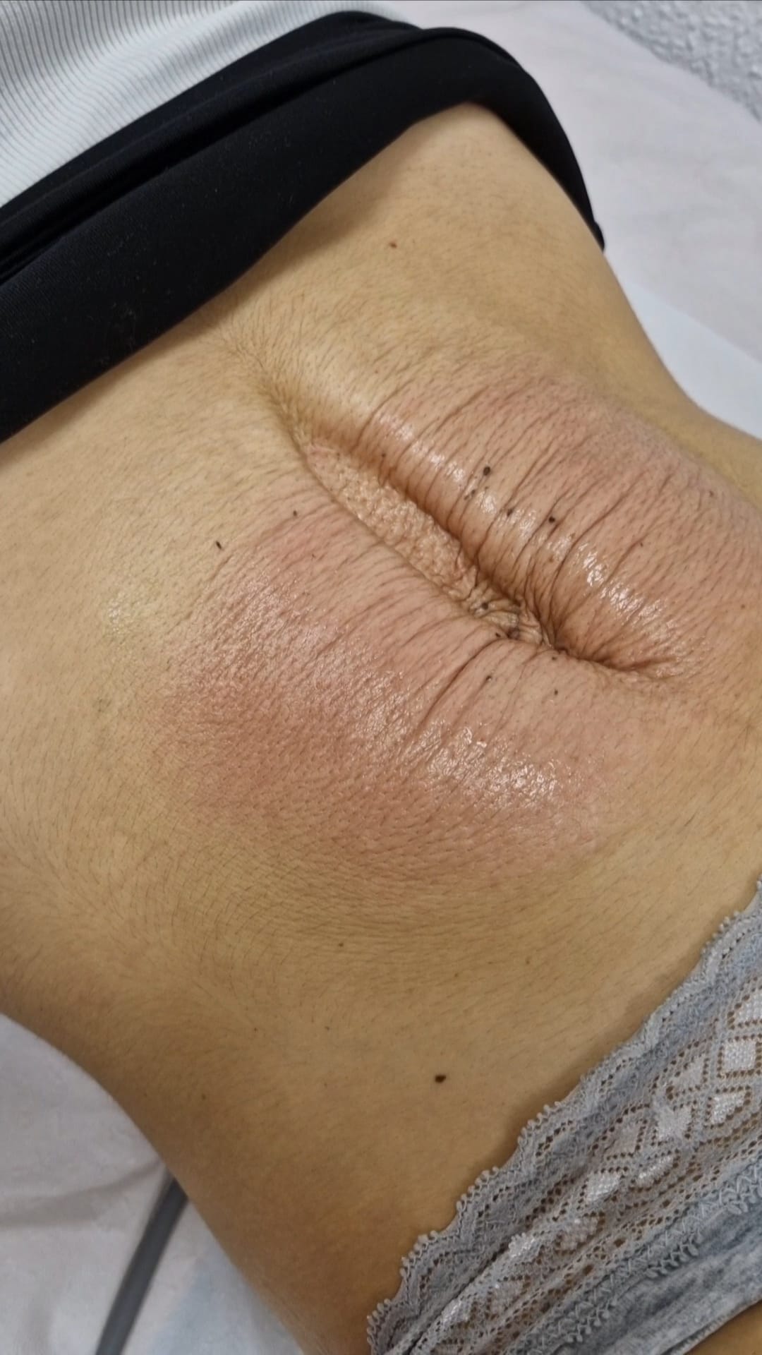 Patología abdominal fisioterapia Santander